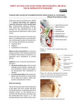 ENDOSCOPIC DACRYOCYSTORHINOSTOMY (DCR) SURGICAL TECHNIQUE Hisham Wasl, Darlene Lubbe