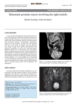 Metastatic Prostate Cancer Involving the Right Testicle