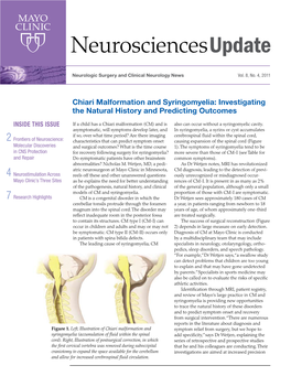 Chiari Malformation and Syringomyelia: Investigating the Natural History and Predicting Outcomes