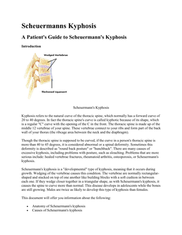 Scheuermanns Kyphosis a Patient's Guide to Scheuermann's Kyphosis