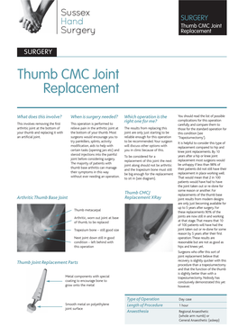 Thumb CMC Joint Replacement