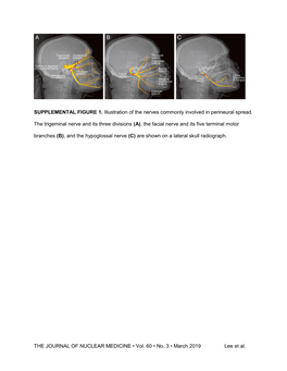 THE JOURNAL of NUCLEAR MEDICINE • Vol. 60 • No. 3 • March 2019 Lee Et Al