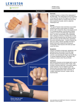 Fifth Metacarpal Bone Boxer's Fracture Phalanx Scissoring Brace May Be