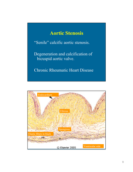 Aortic Stenosis