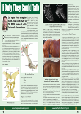 Pelvic Fractures of the Femur