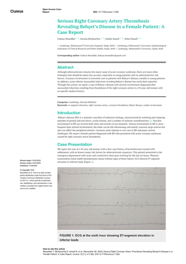 Serious Right Coronary Artery Thrombosis Revealing Behçet's