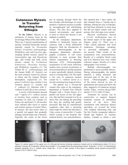 Cutaneous Myiasis in Traveler Returning from Ethiopia