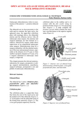 ENDOSCOPIC ETHMOIDECTOMY (FESS) SURGICAL TECHNIQUE Pedro Monteiro, Darlene Lubbe