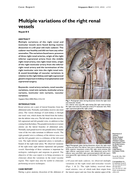 Multiple Variations of the Right Renal Vessels Nayak B S