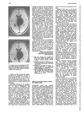 Neuromyelitis Optica Originally Described As a Distinct