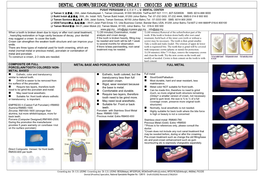 Dental Crown/Bridge/Veneer/Onlay: Choices and Materials