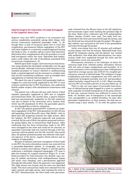 Hybrid Surgery for Extraction of Leads Entrapped in the Superior Vena Cava