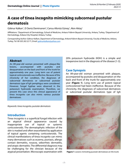 A Case of Tinea Incognito Mimicking Subcorneal Pustular Dermatosis Göknur Kalkan1, D Deniz Demirseren2, Cansu Altınöz Güney1, Akın Aktaş1