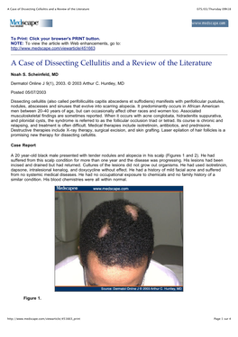 A Case of Dissecting Cellulitis and a Review of the Literature 075/03/Thursday 09H18