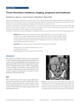 Tumor Thrombus: Incidence, Imaging, Prognosis and Treatment