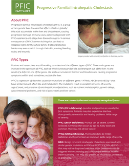 Progressive Familial Intrahepatic Cholestasis FACT SHEET