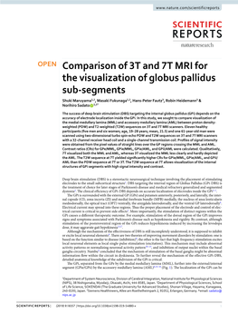 Comparison of 3T and 7T MRI for the Visualization of Globus Pallidus Sub