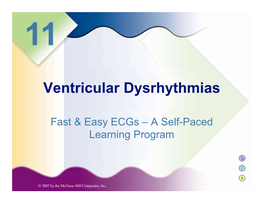 Ventricular Dysrhythmias