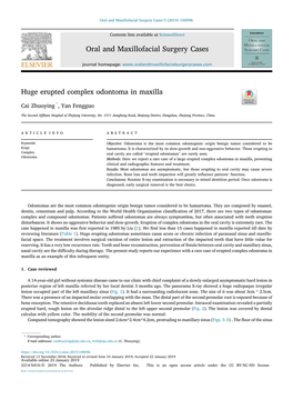Huge Erupted Complex Odontoma in Maxilla