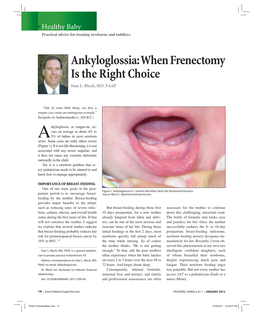 Ankyloglossia: When Frenectomy Is the Right Choice Stan L