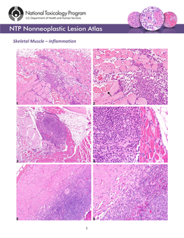 Skeletal Muscle – Inflammation