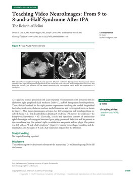 Teaching Video Neuroimages: from 9 to 8-And-A-Half Syndrome After Tpa the Rebirth of Fellini