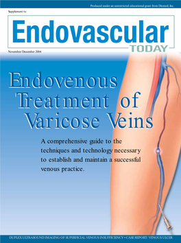 Endovenous Treatment of Varicose Veins