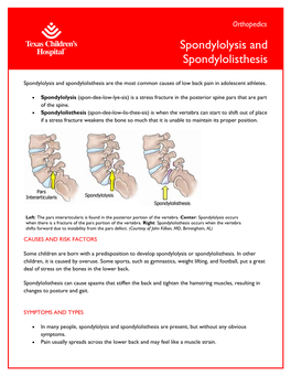 Spondylolysis and Spondylolisthesis