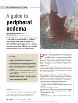 A Guide to Peripheral Oedema