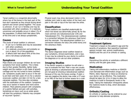 Understanding Your Tarsal Coalition