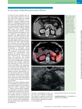 A Rare Cause of Diarrhea: Pancreatic Vipoma