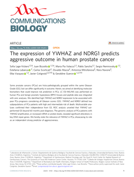 The Expression of YWHAZ and NDRG1 Predicts Aggressive Outcome in Human Prostate Cancer