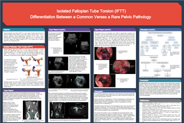 Isolated Fallopian Tube Torsion (IFTT) Differentiation Between a Common Verses a Rare Pelvic Pathology