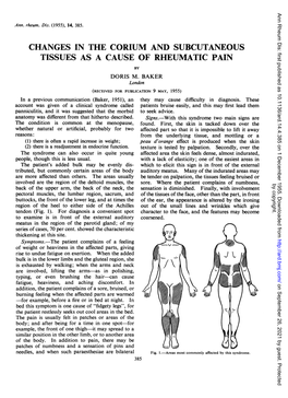 Changes in the Corium and Subcutaneous Tissues As a Cause of Rheumatic Pain by Doris M