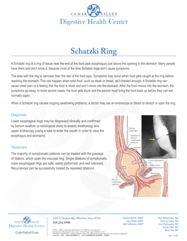 Schatzki Ring