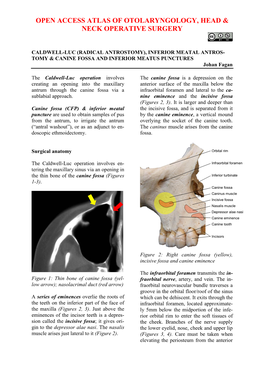 Procedure, Inferior and Canine Fossa Puncture, Inferior Meatal Antrostomy