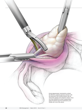 Einarsson-Myomectomy-Article.Pdf