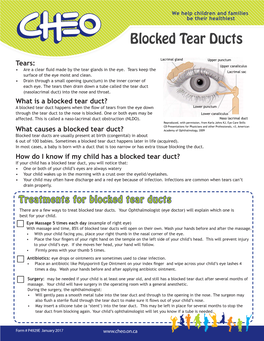 Blocked Tear Ducts