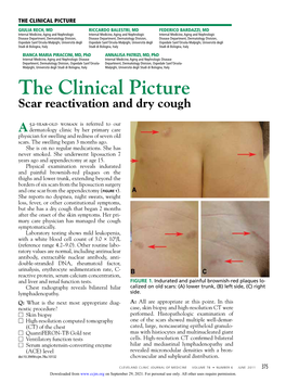 Scar Reactivation and Dry Cough