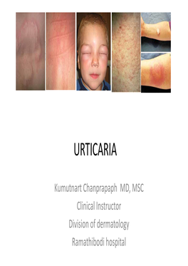 Chronic Urticaria and Angioedma • the Know the Provocative Challenges for Physical Urticaria • Give an Appropriate Investigation • Give Proper Management Urticaria