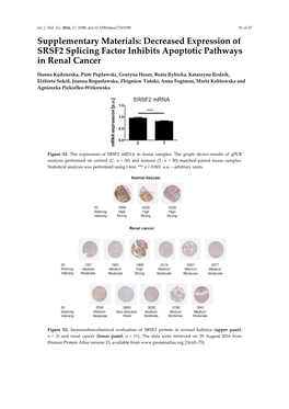 Decreased Expression of SRSF2 Splicing Factor Inhibits Apoptotic Pathways in Renal Cancer