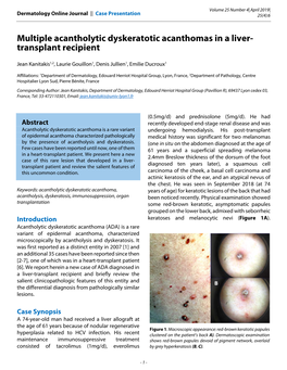 Multiple Acantholytic Dyskeratotic Acanthomas in a Liver- Transplant Recipient