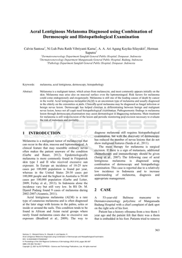 Acral Lentiginous Melanoma Diagnosed Using Combination of Dermoscopic and Histopathological Examination