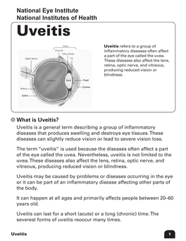 What Is Anterior Uveitis? Anterior Uveitis Occurs in the Front of the Eye