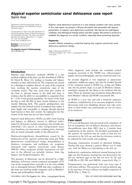 Atypical Superior Semicircular Canal Dehiscence Case Report Samir Asal