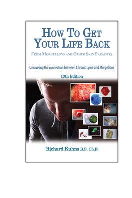 How to Get Your Life Back from Morgellons, Chronic Lyme, and Other Skin Parasites Limited Edition