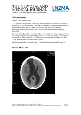 Schizencephaly Sunnya Zarif, Hala Alsafadi a 71-Year-Old Lady Presented to the Acute Medical Unit with Dizziness and Collapse at Home with No Loss of Conscious