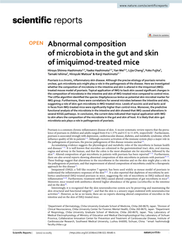 Abnormal Composition of Microbiota in the Gut and Skin of Imiquimod-Treated Mice