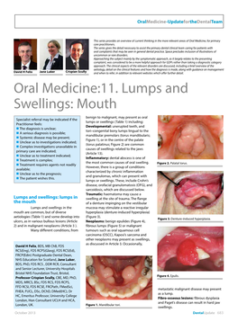 Oral Medicine:11. Lumps and Swellings: Mouth