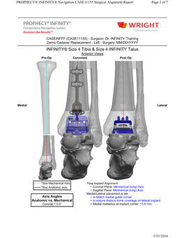 INFINITY® Size 4 Tibia & Size 4 INFINITY Talus